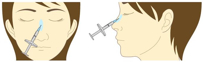 長沙哪些鼻型適合注射玻尿酸