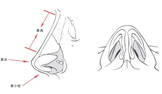 鼻子整形手術