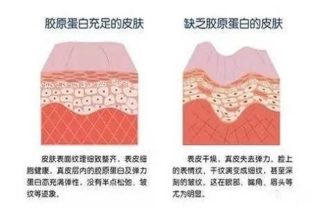 臉部膠原蛋白