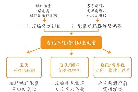 擠痘竟然被送進ICU！你的痘痘還好嗎？