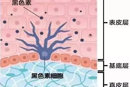 祛斑偏方“害死人”，小仙女們可長點心吧！