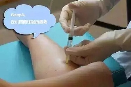 這有一個快速又持久瘦小腿的方法！請注意查收！