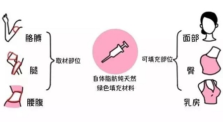 腿再瘦一點(diǎn)？腰再細(xì)一點(diǎn)？胸再大一點(diǎn)？自體脂肪填充，一步到位！