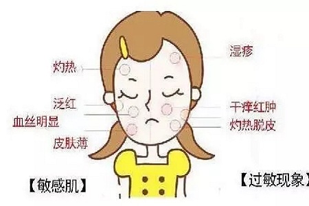 皮膚變成敏感肌怎么辦？如何修復(fù)敏感肌？