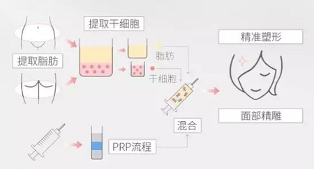 美萊實驗室：瘦臉、ReFa都解決不了你的臉大問題交給我就對了