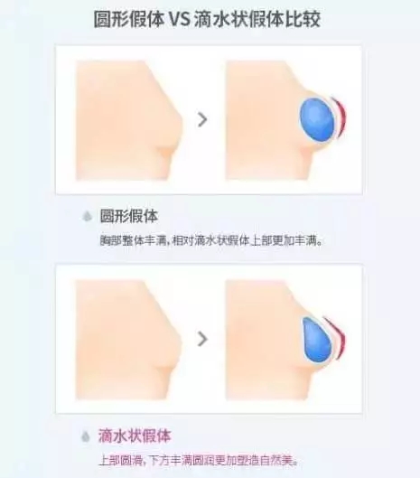 [我問大醫師]隆乳手術問題，你想要的答案，這里都有