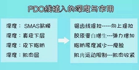 關于*雕，你想了解的都在這里！