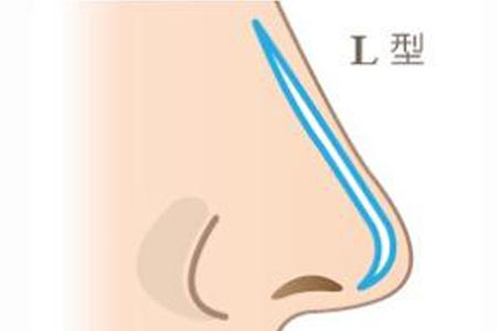 寧波隆鼻醫院手術價格表