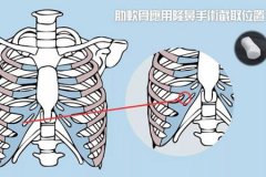 深圳隆鼻醫院做軟骨隆鼻多少錢，術后安全嗎